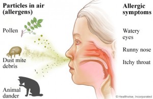 rhinitis caused